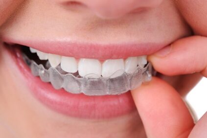 Orthodontic-Treatment