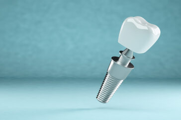 Dental implant, dental prosthesis with copy space. 3d rendering