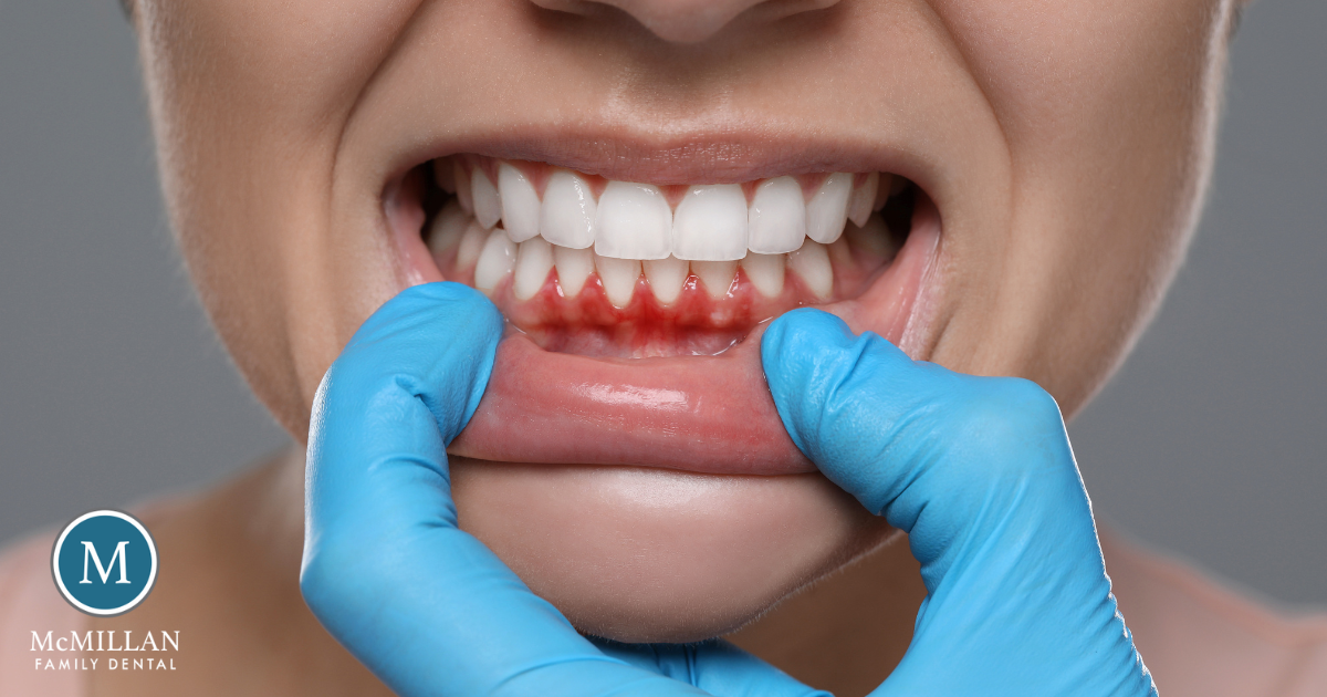 Smith Blog August 2025