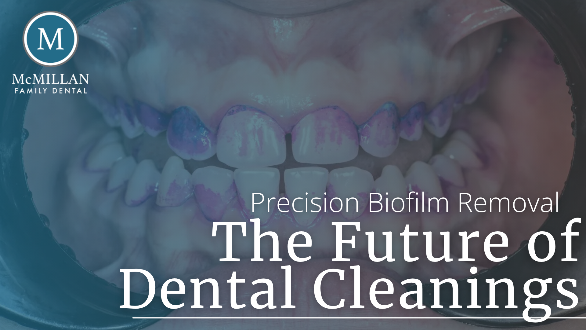 dental picture